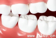 齿科口腔专家详解半口种植牙全过程