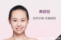 美容冠矫正的保养 更好的护理才能让牙齿美容